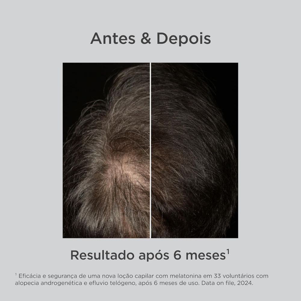 ISDIN HairCare Melatonina Antiqueda Noturno - Miniatura 3