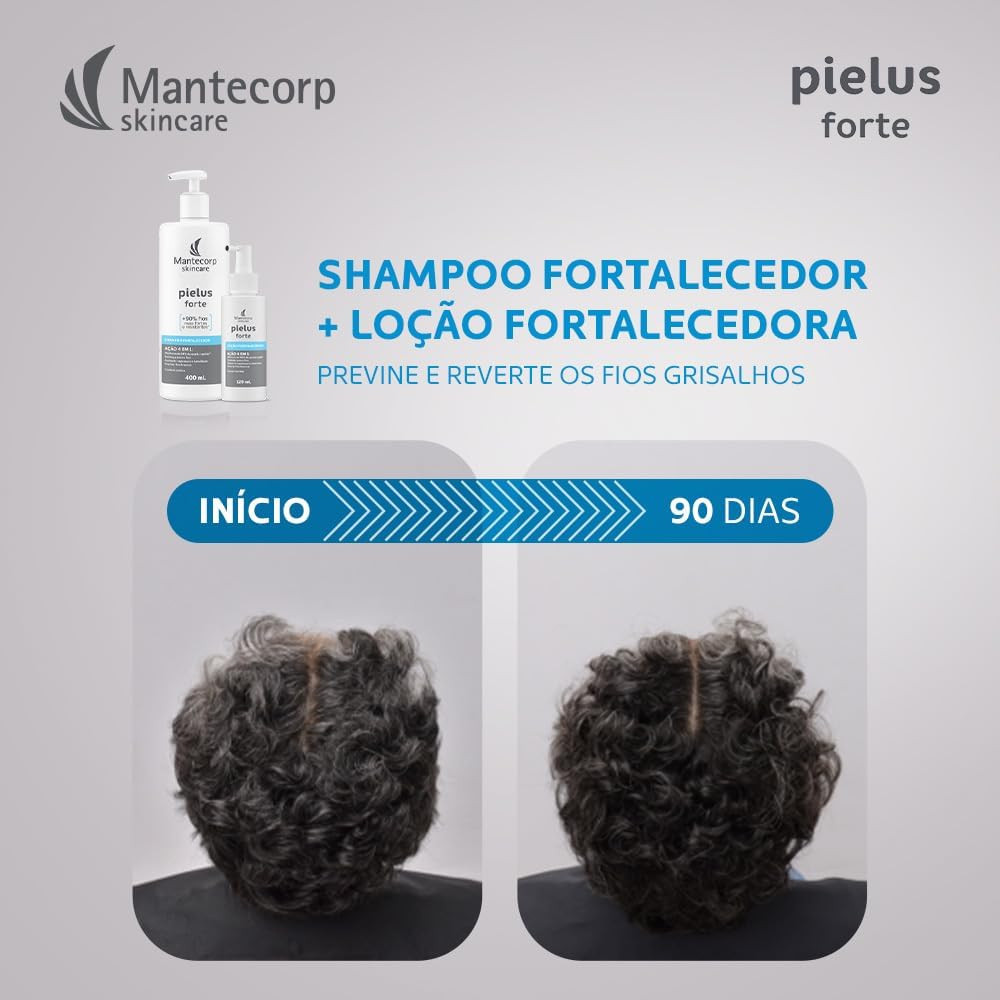 Mantecorp Pielus Forte Antiqueda Intensivo - Miniatura 4